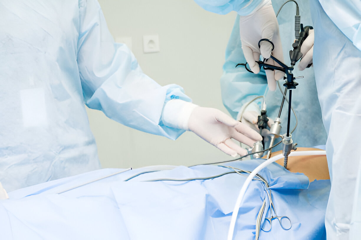 Laparoscopic Hernioplasty