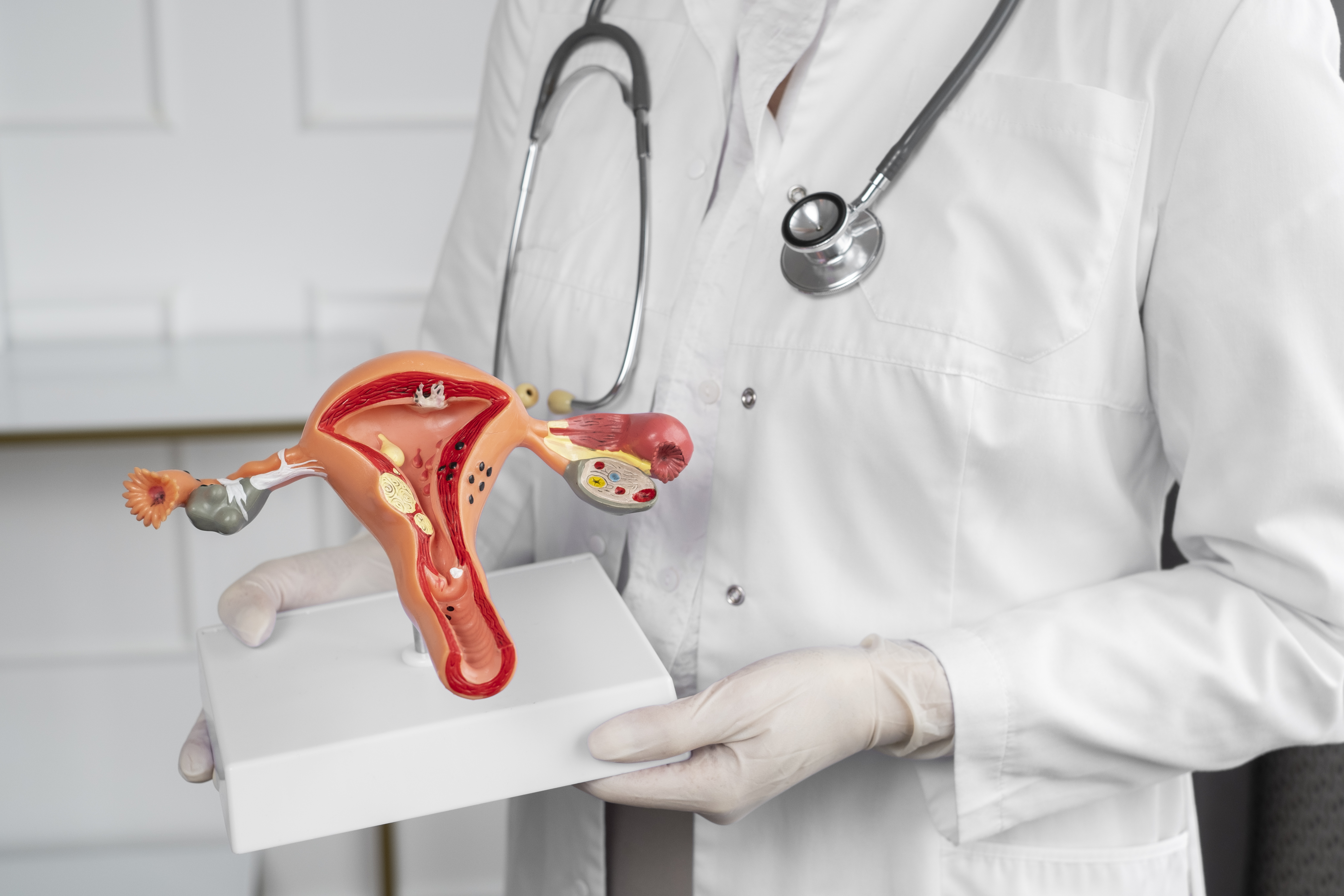 Fistula Treatment